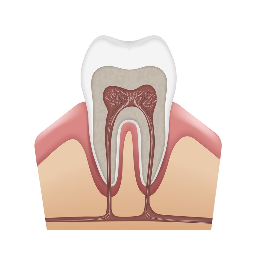 Pulpotomy